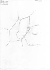 Allium cepa einzelne Zelle plasmolysiert