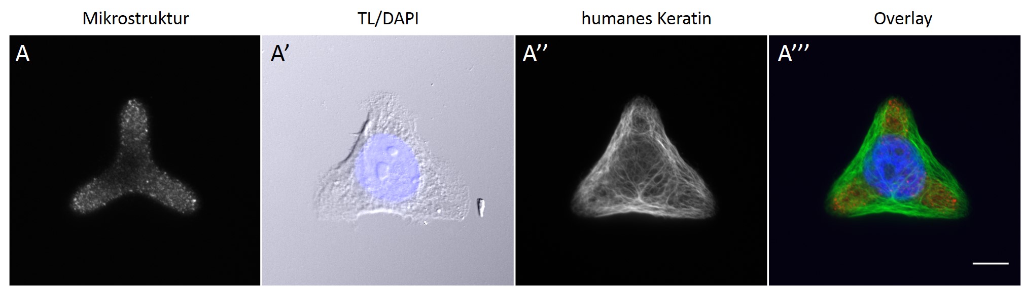 Cell micropatterning normalisierte Zelle HaCaT Keratin