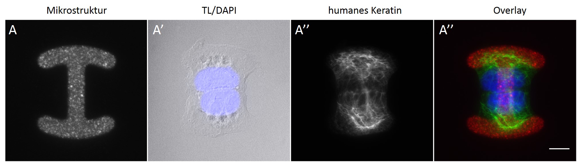 Zell-Zell-Kontakte Keratin cell micropatterning micropattern