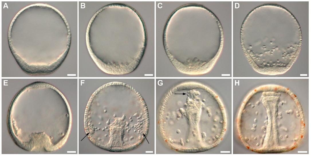 Gastrulation eines Echinoderms