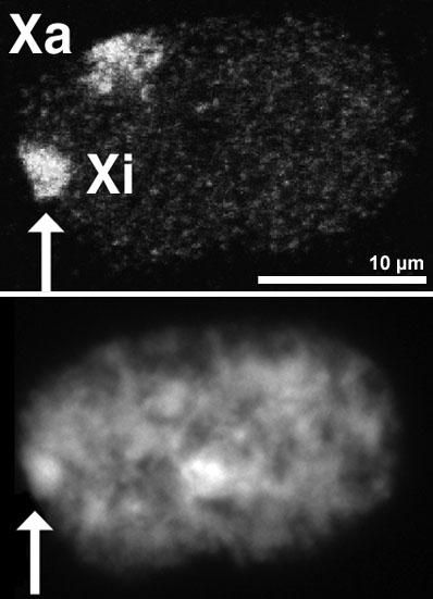 Barr-Körperchen