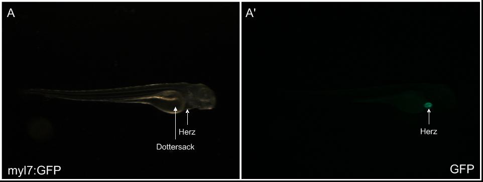 Lokalisation eines myl7GFP_LA-GFP Konstrukts im Myokard einer transgenen Zebrafischlinie