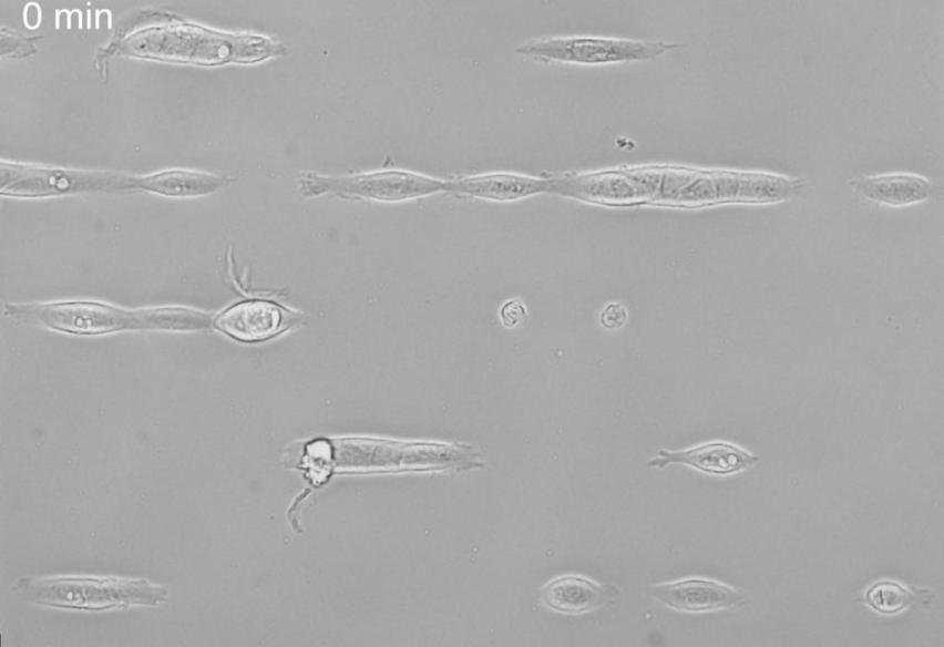 cell micropattering cell migration on fibronectin  stripes HaCaTB10EGF 20 ng 29h after seeding