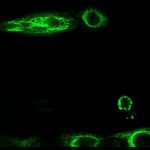 cell micropattering cell migration on fibronectin stripes HaCaTB10 keratin 5 EGF 20 ng