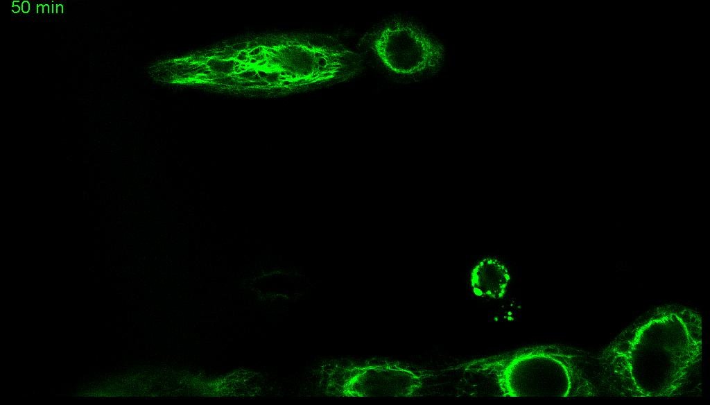 cell micropattering cell migration on fibronectin stripes HaCaTB10 keratin 5 EGF 20 ng